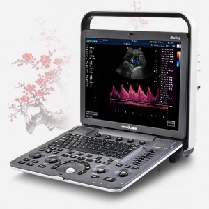 Ультразвуковой сканер S8Exp